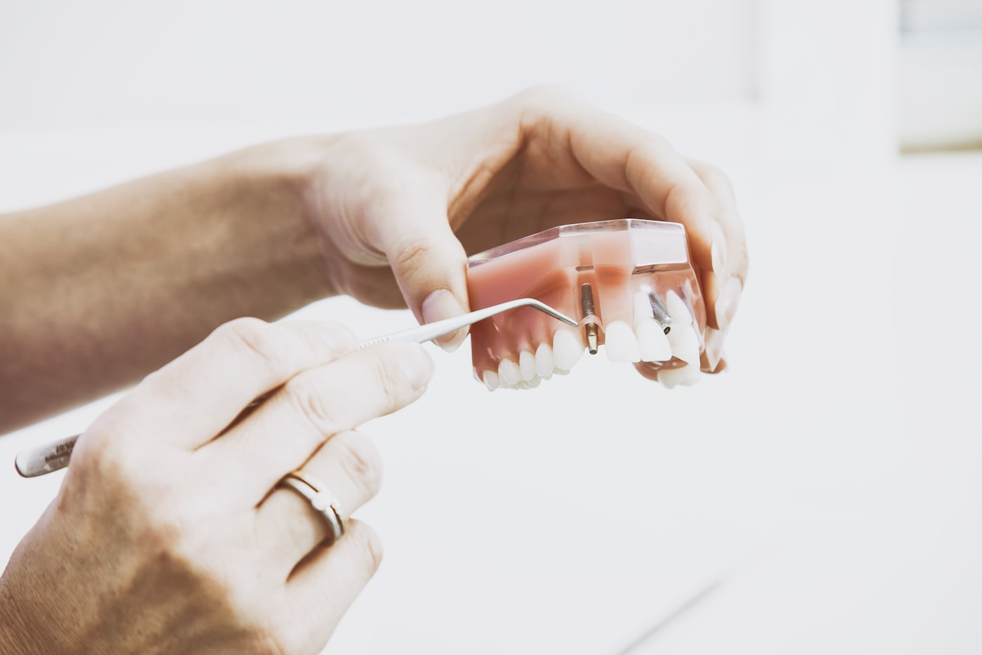 Prótese Dentária Fixa