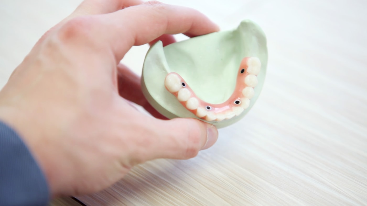 Prótese Dentária Removível