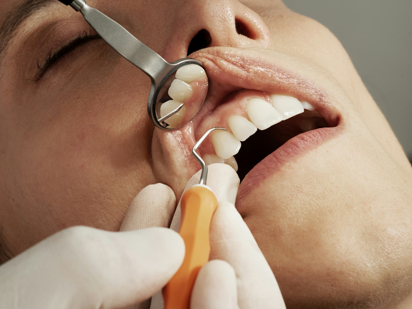 Consulta de Avaliação Dentária