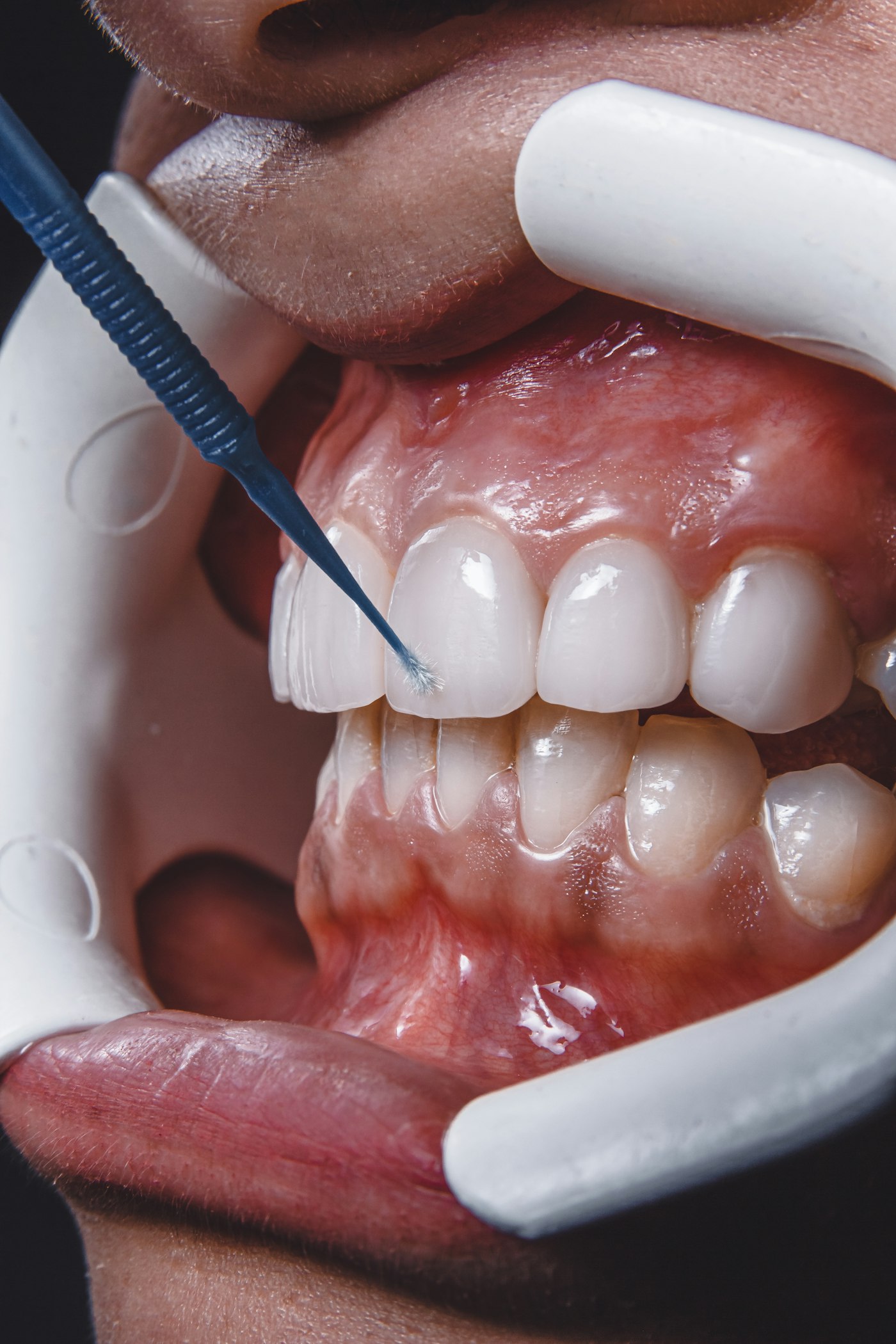 Medicina Oral