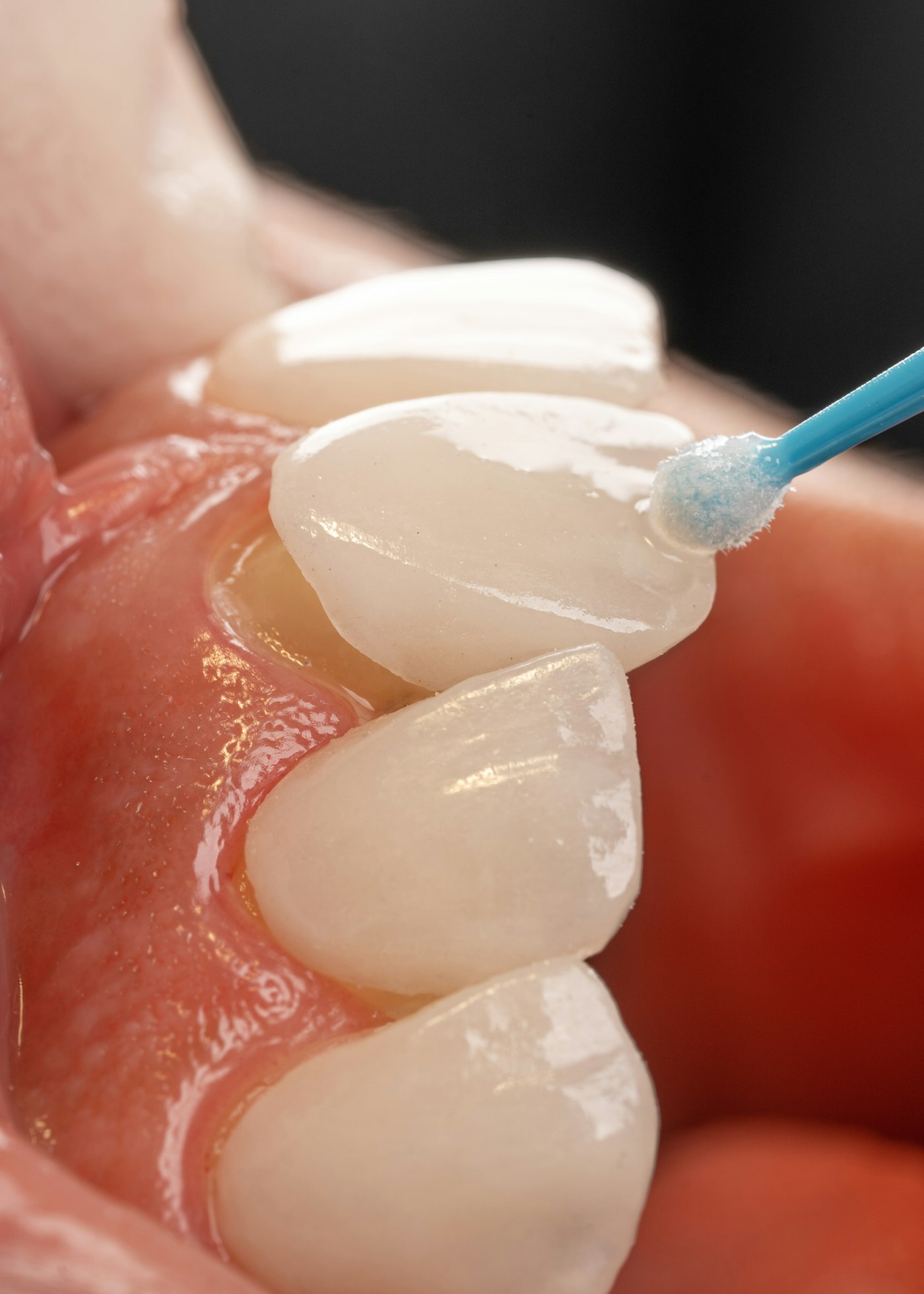 Dentisteria